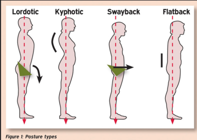 How Chiropractic Care Can Improve Your Posture - Abundant Life ...